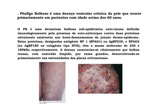 . Pênfigo Bolhoso é uma doença vesicular crônica da pele que ocorre
primariamente em pacientes com idade acima dos 60 anos.
O PB é uma dermatose bolhosa sub-epidérmica auto-imune definida
imunologicamente pela presença de auto-anticorpos contra duas proteínas
estruturais existentes nos hemi-desmossomos da junção derme-epiderme.
Estas proteínas, designadas antigénio BP 1 (BPAG1) ou AgBP230, e BPAG2
(ou AgBP180 ou colagénio tipo XVII), têm a massa molecular de 230 e
180kDa respectivamente. A doença caracteriza-se clinicamente por bolhas
tensas, com conteúdo límpido, por vezes grandes, desenvolvendo-se
primariamente nas extremidades das placas eritematosas.
 
