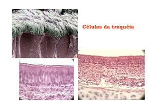 Células da traquéia
 