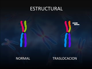 Fuente: 1. On-line Mendelian Inheritage in Men. 2. A.J. Solari, Genética Humana (2ª Edición)
ESTRUCTURAL
NORMAL TRASLOCACION
 