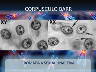 Fuente: 1. On-line Mendelian Inheritage in Men. 2. A.J. Solari, Genética Humana (2ª Edición)
CORPUSCULO BARR
CROMATINA SEXUAL INACTIVA
 