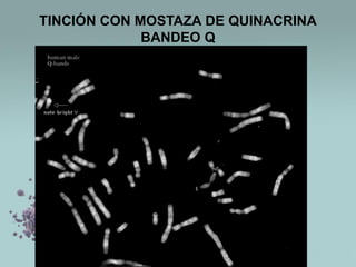 TINCIÓN CON MOSTAZA DE QUINACRINA
BANDEO Q

 