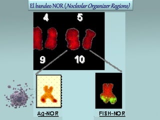 El bandeo NOR (Nocleolar Organizer Regions)

 