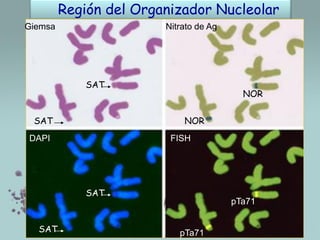 Región del Organizador Nucleolar
Giemsa

Nitrato de Ag

SAT

SAT

NOR
NOR

DAPI

FISH

SAT

SAT

pTa71

pTa71

 