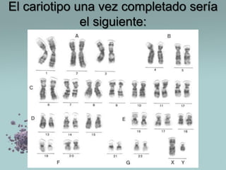 El cariotipo una vez completado sería
el siguiente:

 