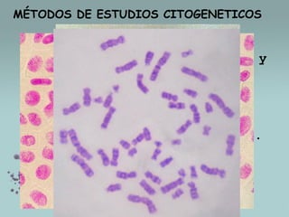 MÉTODOS DE ESTUDIOS CITOGENETICOS

 inclusión
en
parafina
cortes con micrótomo,

y

 técnica de aplastado
 cultivo celulares "in vitro".

 