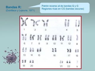 Bandas R:
(Dutrillaux y Lejeune, 1971)

Patrón reverso al de bandas Q y G
Regiones ricas en CG (bandas oscuras)

 