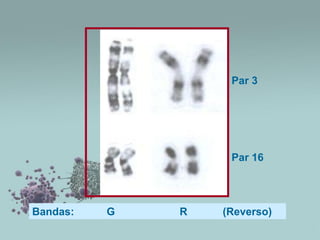 Par 3

Par 16

Bandas:

G

R

(Reverso)

 