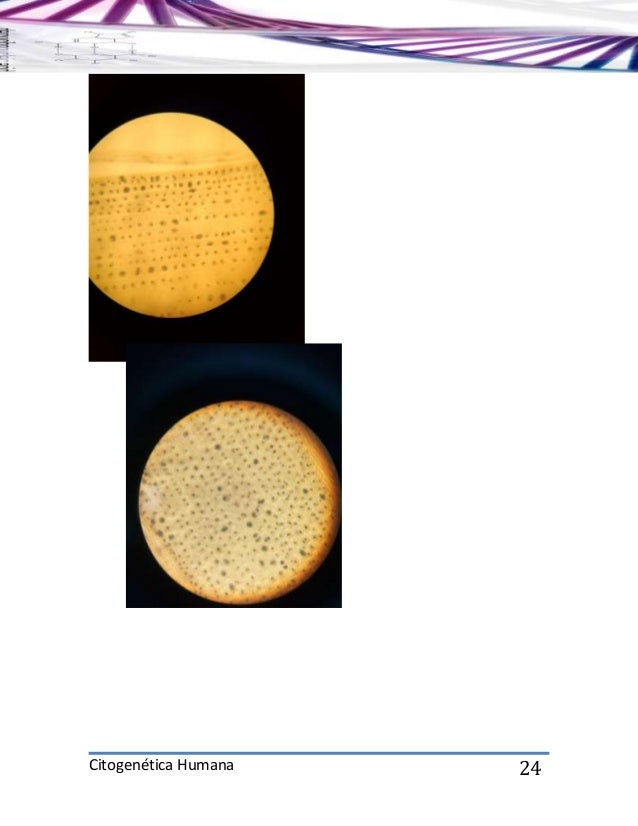Citogenetica humana Citogenetica humana