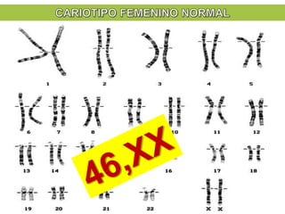 Existen tres tipos de cromosomas humanos
por el tamaño de sus brazos “p” y “q”
Metacéntrico Submetacéntrico Acrocéntrico
p...