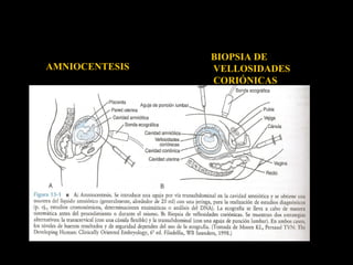 AMNIOCENTESIS

BIOPSIA DE
VELLOSIDADES
CORIÓNICAS

 
