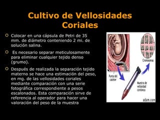 Cultivo de Vellosidades
Coriales
 Colocar en una cápsula de Petri de 35
mm. de diámetro conteniendo 2 mi. de
solución salina.
 Es necesario separar meticulosamente
para eliminar cualquier tejido denso
(grumo).
 Después de realizada la separación tejido
materno se hace una estimación del peso,
en mg. de las vellosidades coriales
mediante comparación con una serie
fotográfica correspondiente a pesos
escalonados. Esta comparación sirve de
referencia al operador para hacer una
valoración del peso de la muestra

 