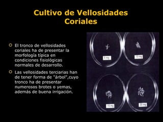 Cultivo de Vellosidades
Coriales
 El tronco de vellosidades
coriales ha de presentar la
morfología típica en
condiciones fisiológicas
normales de desarrollo.
 Las vellosidades terciarias han
de tener forma de "árbol",cuyo
tronco ha de presentar
numerosos brotes o yemas,
además de buena irrigación.

 