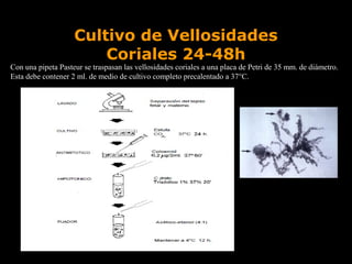 Cultivo de Vellosidades
Coriales 24-48h

Con una pipeta Pasteur se traspasan las vellosidades coriales a una placa de Petri de 35 mm. de diámetro.
Esta debe contener 2 ml. de medio de cultivo completo precalentado a 37°C.

 