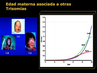 Edad materna asociada a otras
Trisomías

 