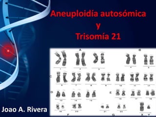 Aneuploidía autosómica
y
Trisomía 21

Joao A. Rivera

 