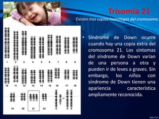 Trisomía 21
Existen tres copias homólogas del cromosoma.

• Síndrome de Down ocurre
cuando hay una copia extra del
cromosoma 21. Los síntomas
del síndrome de Down varían
de una persona a otra y
pueden ir de leves a graves. Sin
embargo, los niños con
síndrome de Down tienen una
apariencia
característica
ampliamente reconocida.

 