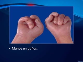 • Manos en puños.

 