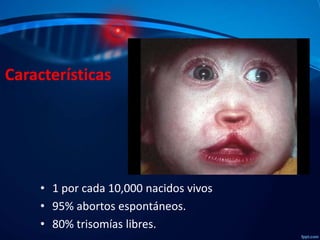 Características

• 1 por cada 10,000 nacidos vivos
• 95% abortos espontáneos.
• 80% trisomías libres.

 