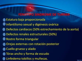 FENOTIPO SINDROME DE TURNER
Estatura baja proporcionada
Infantilismo sexual y digénesis ovárica
Defectos cardiacos (50% estrechamiento de la aorta)
Defectos renales estructurales (50%)
.
Rostro forma triangular
Orejas externas con rotación posterior
Cuello grueso y alado
Tórax ancho y forma de escudo
Linfedema tobillos y muñecas.

 