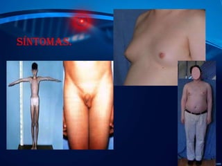 Síntomas.

 
