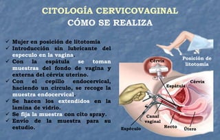 CITOLOGÍA CERVICOVAGINAL
CÓMO SE REALIZA
 Mujer en posición de litotomía
 Introducción sin lubricante del
especulo en la vagina.
 Con la espátula se toman
muestras del fondo de vagina y
externa del cérvix uterino.
 Con el cepillo endocervical,
haciendo un circulo, se recoge la
muestra endocervical.
 Se hacen los extendidos en la
lamina de vidrio.
 Se fija la muestra con cito spray.
 Envío de la muestra para su
estudio. Espéculo
Canal
vaginal
Posición de
litotomía
Recto
Útero
Cérvix
Espátula
Cérvix
 