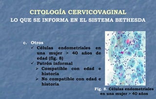 c. Otros
 Células endometriales en
una mujer > 40 años de
edad (fig. 8)
 Patrón informal
 Compatible con edad e
historia
 No compatible con edad e
historia
CITOLOGÍA CERVICOVAGINAL
LO QUE SE INFORMA EN EL SISTEMA BETHESDA
Fig. 8. Células endometriales
en una mujer > 40 años
 
