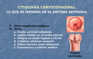 CITOLOGÍA CERVICOVAGINAL
LO QUE SE INFORMA EN EL SISTEMA BETHESDA
C. Otras neoplasias malignas
D. Otros
a. Cuello cervical inflamado
b. Lesión visible en el cuello uterino
c. Pólipos en canal vaginal o cérvix
d. Cambios celulares menores
e. Deben hacerse otros exámenes
f. Tratamiento a criterio médico
Pólipos
cervicales
 