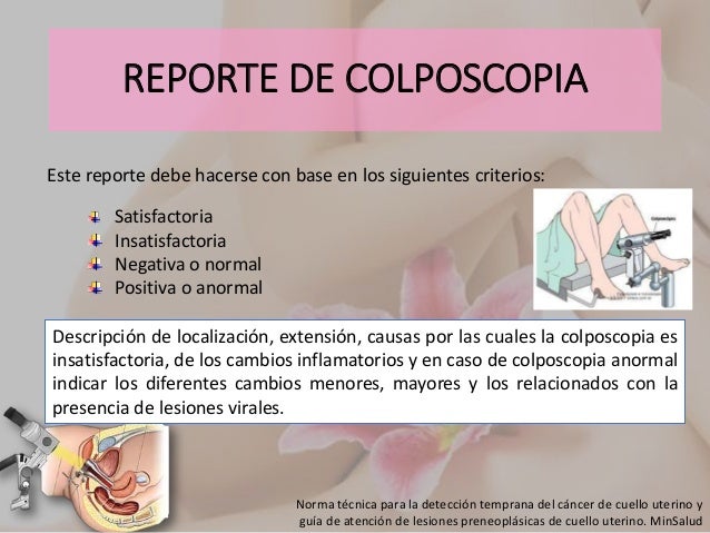 Exame de colposcopia com biopsia
