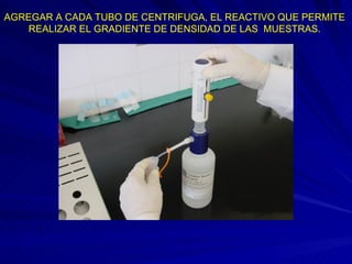 AGREGAR A CADA TUBO DE CENTRIFUGA, EL REACTIVO QUE PERMITE REALIZAR EL GRADIENTE DE DENSIDAD DE LAS  MUESTRAS. 