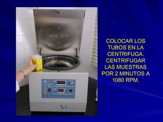 COLOCAR LOS TUBOS EN LA CENTRIFUGA. CENTRIFUGAR LAS MUESTRAS POR 2 MINUTOS A 1080 RPM. 