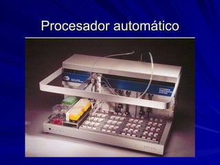 Procesador automático 