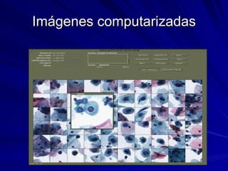 Imágenes computarizadas 