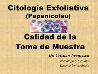 Citología Exfoliativa
    (Papanicolau)


    Calidad de la
  Toma de Muestra
          Dr. Cristian Francisco
               Ginecólogo / Oncólogo
                Docente Universitario
 