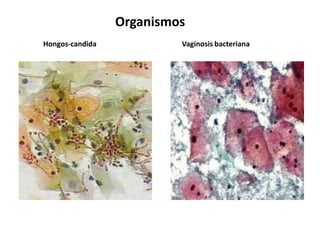 Organismos
Hongos-candida            Vaginosis bacteriana
 