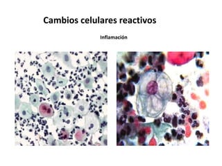 Cambios celulares reactivos
             Inflamación
 