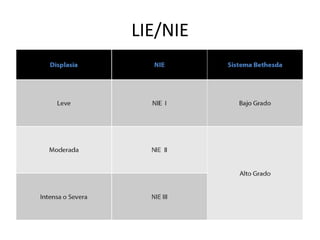 LIE/NIE
 