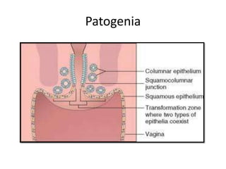 Patogenia
 