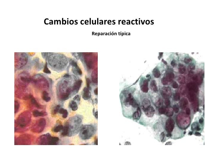 Citología y pap Citología y pap