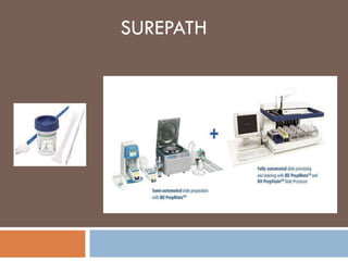 SUREPATH 