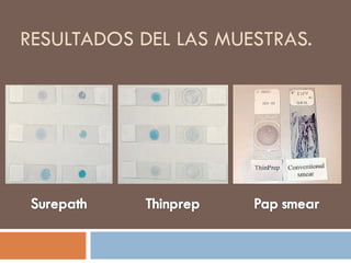 RESULTADOS DEL LAS MUESTRAS. 