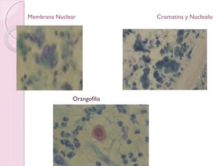 Membrana Nuclear Cromatina y Nucleolo 
Orangofilia 
 