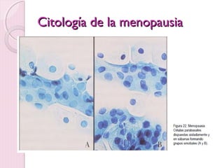 CCiittoollooggííaa ddee llaa mmeennooppaauussiiaa 
 