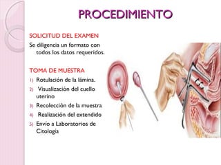 PPRROOCCEEDDIIMMIIEENNTTOO 
SOLICITUD DEL EXAMEN 
Se diligencia un formato con 
todos los datos requeridos. 
TOMA DE MUESTRA 
1) Rotulación de la lámina. 
2) Visualización del cuello 
uterino 
3) Recolección de la muestra 
4) Realización del extendido 
5) Envío a Laboratorios de 
Citología 
 