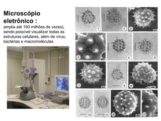 Microscópio
eletrônico :
amplia até 100 milhões de vezes),
sendo possível visualizar todas as
estruturas celulares, além de vírus,
bactérias e macromoléculas
 