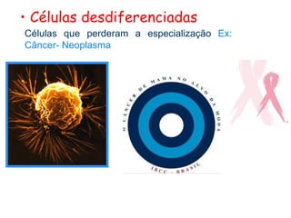 • Células desdiferenciadas
Células que perderam a especialização Ex:
Câncer- Neoplasma
 