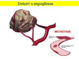 Induzir a angiogênese




                        METÁSTASE
 