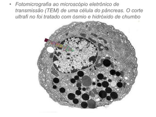 • Fotomicrografia ao microscópio eletrônico de
transmissão (TEM) de uma célula do pâncreas. O corte
ultrafi no foi tratado com ósmio e hidróxido de chumbo
 