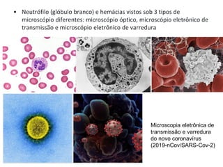 • Neutrófilo (glóbulo branco) e hemácias vistos sob 3 tipos de
microscópio diferentes: microscópio óptico, microscópio eletrônico de
transmissão e microscópio eletrônico de varredura
Microscopia eletrônica de
transmissão e varredura
do novo coronavírus
(2019-nCov/SARS-Cov-2)
 