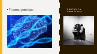 C A U S A S D A
D E P R E S S Ã O
• Fatores genéticos
 