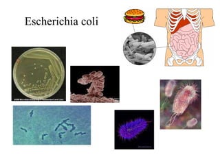 Escherichia coli 